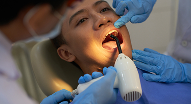 Oral Cancer Screening