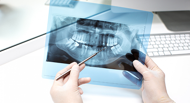 Dental X-Rays