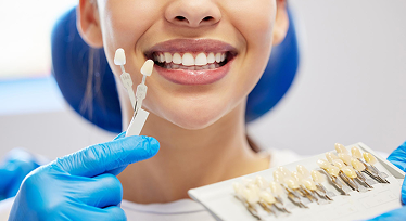 Dental Veneers