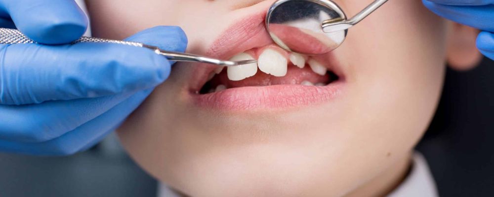 dentist examines the teeth of the patient child